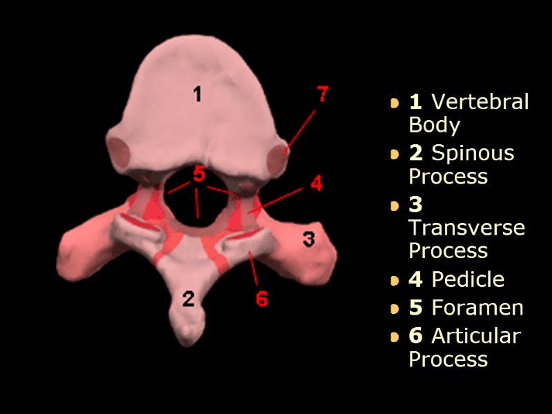 1 Vertebral Body  2 Spinous Process  3 Transverse Process 4 Pedicle 